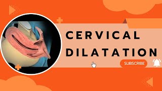 Cervical Dilatation [upl. by Lilyan465]