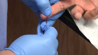 Phlebotomy Dermal Capillary Punctures  Blood Collection RxTN [upl. by Bord]