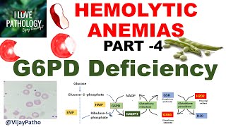 Hemolytic Anemias Part 4 G6PD Deficiency PathophysiologyMorphology clinical features [upl. by Chambers]