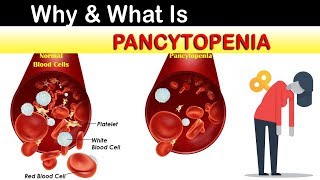 Why amp What Is Pancytopenia [upl. by Pietje]