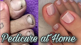 Pedicure at home Transformation from dirty to clean nails  Pedicure followingmydream [upl. by Shela]