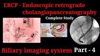 ERCP Procedure  Endoscopic retrograde cholangiopancreatography  biliary imaging system part 3 [upl. by Story785]