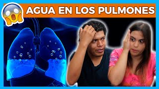 AGUA en los PULMONES es grave 😱 Sintomas de edema pulmonar 😵 Junica IRC [upl. by Ysabel]