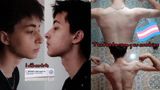 🏳️‍⚧️ Tratamiento hormonal en chicos trans  1 año en testosterona mi experiencia [upl. by Eyaj64]