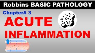 Chp3 Part2 Robbins Basic Patho  ACUTE INFLAMMATION  Dr Asif Lectures [upl. by Cherida]