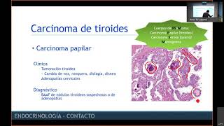 ENARM 2021 clase de Endocrinología parte 2 [upl. by Nairadal]