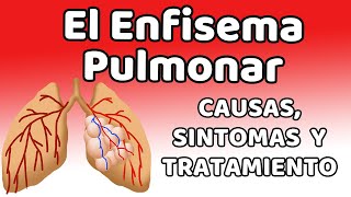 ENFISEMA Causas signos y síntomas diagnóstico y tratamiento [upl. by Morven]