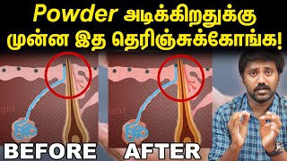 Powder வியர்குருவைக் குறைக்குமா  Are prickly heat powders really effective  Uyirmei Episode  29 [upl. by Kopp766]