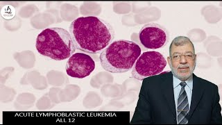 Acute Lymphoblastic Leukemia 12 ALL [upl. by Ahtnammas]