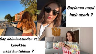 SAÇ DÖKÜLMESİNDEN VE KEPEKTEN NASIL KURTULDUM Saçlarım nasıl hızlı uzadı En ucuz yöntemler [upl. by Teresa883]