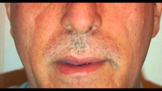 Time Lapse Moustache Growth [upl. by Atin]