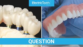 Dentures vs Implants [upl. by Retepnhoj466]