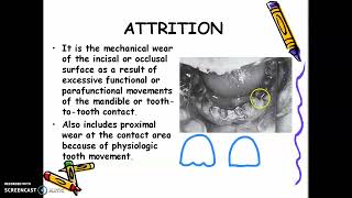 Lecture Day 4 Noncarious Tooth Defects [upl. by Enwad]