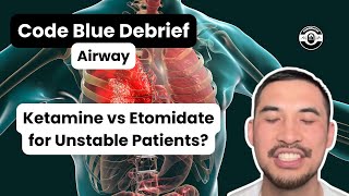 Ketamine vs Etomidate for Unstable Patients  Rapid Sequence Intubation  CodeBlueDebrief [upl. by Lidah]