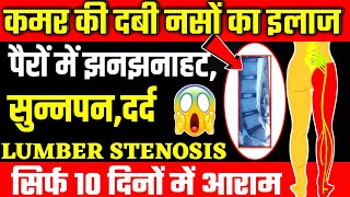 लंबर स्टेनोसिस की एक्सरसाइजSpinal Stenosis ExerciseLumbar Stenosis Exercises [upl. by Brand]