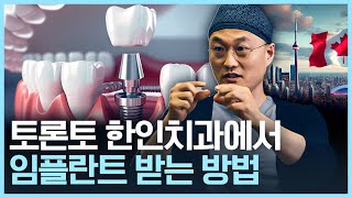 토론토에서 한인 치과 임플란트 시술 어떻게 받는지 알려드립니다 [upl. by Sivehc]