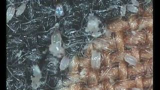 house dust mites [upl. by Ahseikal]