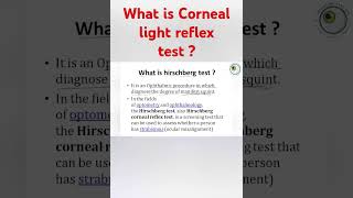 hirschberg corneal reflex test  corneal light reflex test  interpretation of hirschberg test [upl. by Veron]