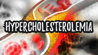 Hypercholesterolemia High Cholesterol  CRASH Medical Review Series [upl. by Halden]