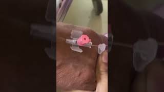 IV cannula insertiondoctornursingmotivationshortvideoviralvideo [upl. by Doloritas]