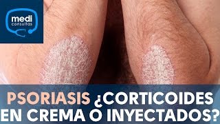 Psoriasis ¿corticoides en crema o inyectados MediConsultas [upl. by Adnilram513]