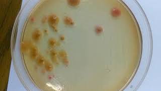 Salmonella Positive  Salmonella Shigella Agar [upl. by Noval]