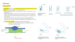 NSTEMI angiographic and PCI tips [upl. by Corinna]