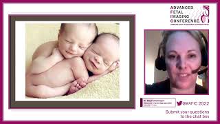 Double Trouble Imaging Twins for the Community Sonographer  Dr Stephanie Cooper  AFIC [upl. by Nibbs]