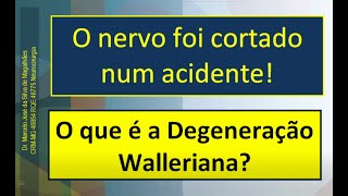 O que é a degeneração Walleriana após a lesão de um nervo DrMarcelo José da Silva de Magalhães [upl. by Elamrej]