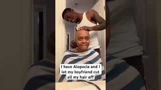 alopecia alopeciaawareness baldwomen bigchop hairtransformation bald [upl. by Swisher]