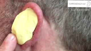 Impression Taking Steps Tutorial Video for Custom Earmolds [upl. by Iew]