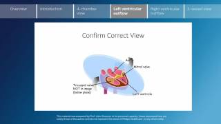 Key screening views of the fetal heart  Part 4  Left ventricular outflow [upl. by Nodnrb]