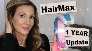 HairMax Laserband 82  1 Year Hair Growth Update [upl. by Annahtur]