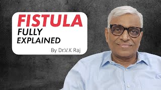 Fistula Kya Hota Hai  Treatment  DrVK Raj [upl. by Cele]