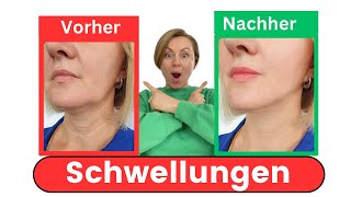 Schwellungen wo sitzt das wahre Probleme… [upl. by Iroc]