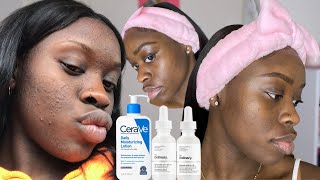 HOW TO CLEAR TEXTURED SKIN  My Fungal Acne Skincare Routine  The Ordinary Curology amp Cerave [upl. by Ternan]