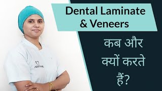 Dental Laminate amp Veneers When How amp Why l कब और क्यों करते हैं [upl. by Yunick]