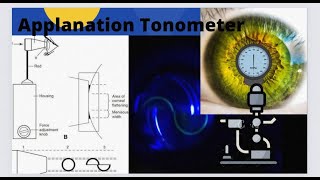 An introduction to Goldmann Applanation Tonometry [upl. by Eenahpets326]