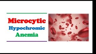 Hematology 🔤  Microcytic Hypochromic Anemia [upl. by Shiau]