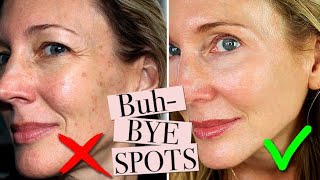 How To Get Rid of Age Spots [upl. by Myles]