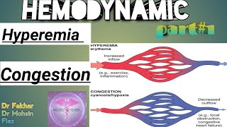 Hemodynamic disorder part  1 Hyperemia and congestion [upl. by Azial]