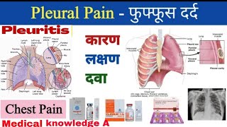 Pleuralpain  pleuraltitis संक्रमण के कारण और उपचार Chest pain in hindi फुफ्फूशीय दर्दnursing [upl. by Naahsar560]