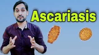 Ascariasis Infection  Ascaris Lumbricoides  Diagnosis  Life Cycle and Treatment [upl. by Anema]