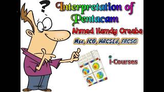 Pentacam Interpretation English [upl. by Susy]