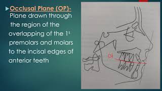 Cephalometric Planes [upl. by Akere]