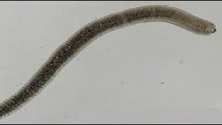 Para GIT  Hymenolepis Nana  Dwarf tape worm   الدودة القزمة [upl. by Zat]