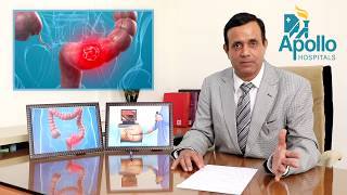 Colonoscopy Sigmoidoscopy in Hindi Dr Shravan Bohra liver specialistApolloAhmedabad [upl. by Nujra]