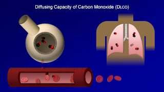 Pulmonary Function Tests PFT Lesson 4  DLCO [upl. by Grunberg]