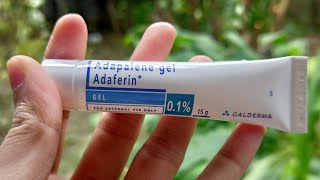 Unveiling the Facts About Adapalene Key Ingredient in Differin Gel [upl. by Holna510]