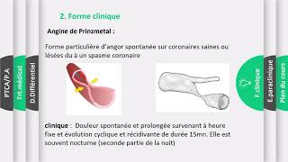 Angine de poitrine Partie 02 INSEN Academy [upl. by Sitoel264]